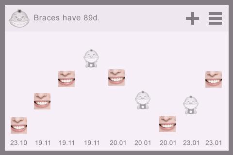 Braces