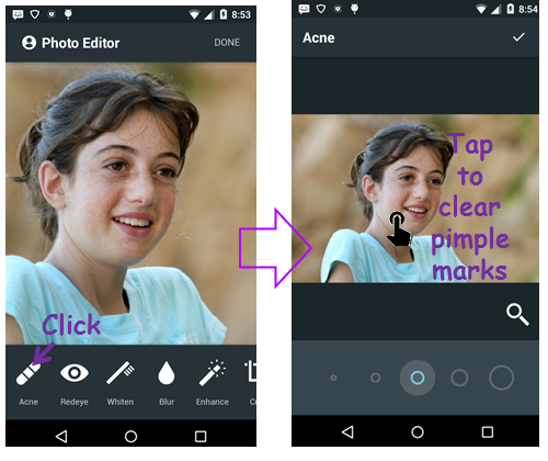 Face Acne Remover Photo Editor