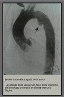 Radiografias de examenes