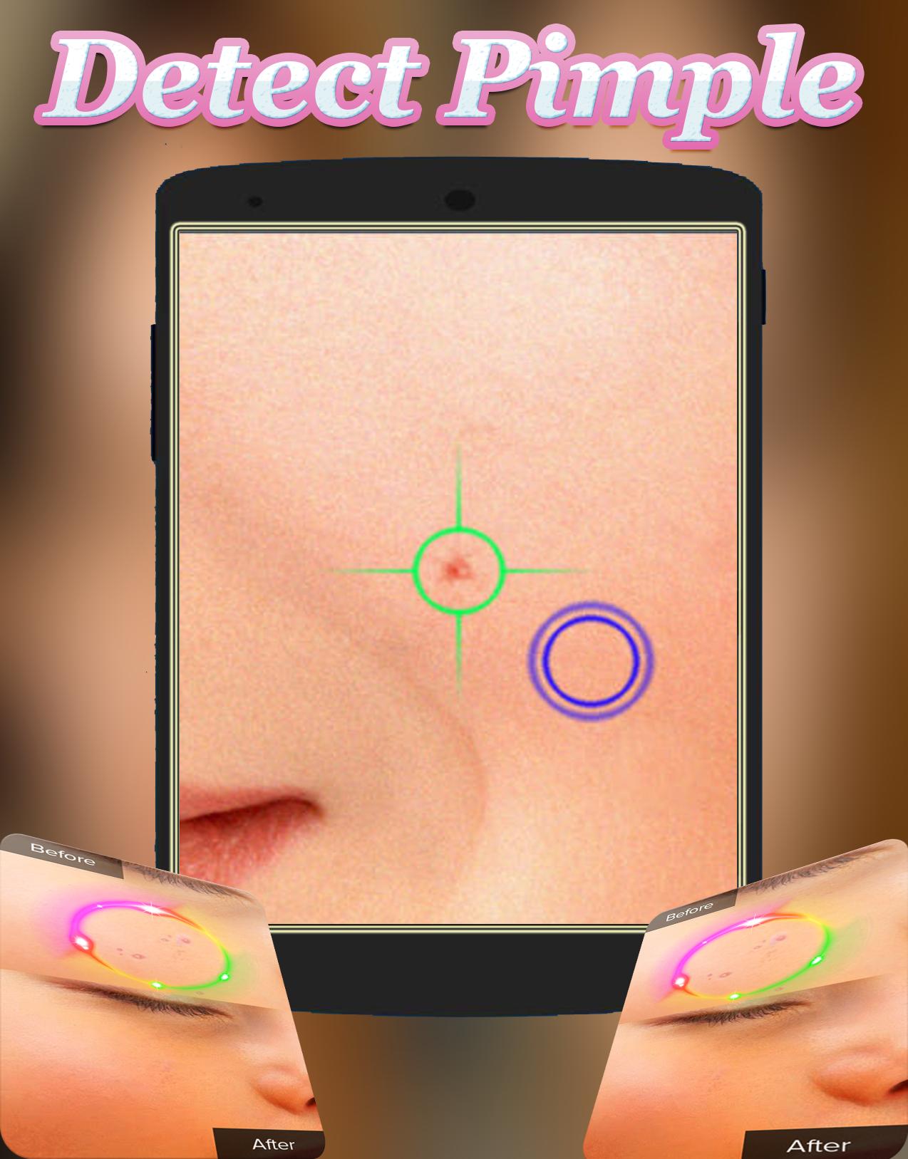 Face Blemishes Cleaner & Face Pimple Removal