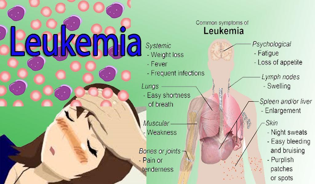 Leukemia