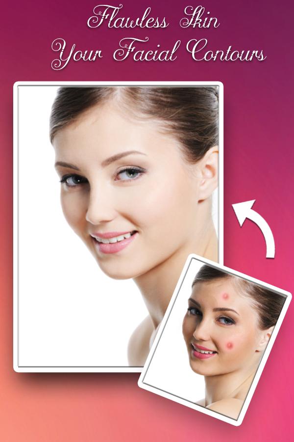 Acne Remover - Pimple Remover