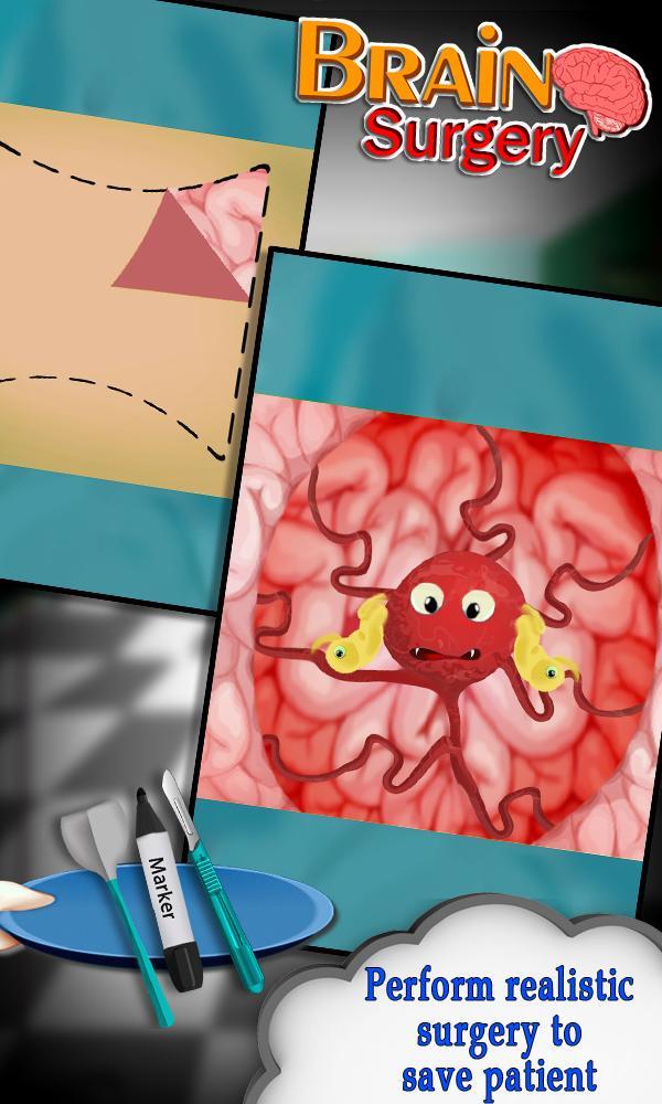 Brain Operation Surgery Doctor